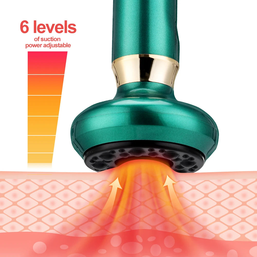 Smart Vacuum Cupping Massage Set